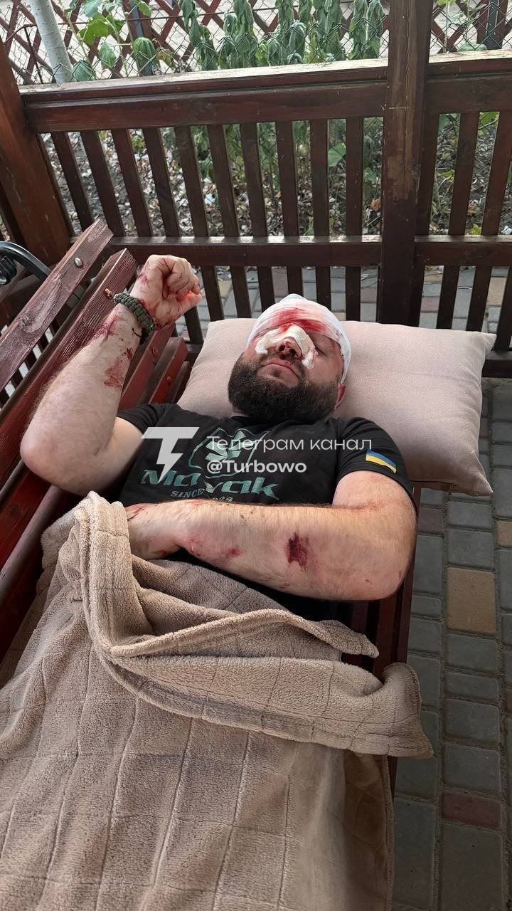 У Затоці чоловік жорстоко побив ветерана АТО через прохання вимкнути російську…